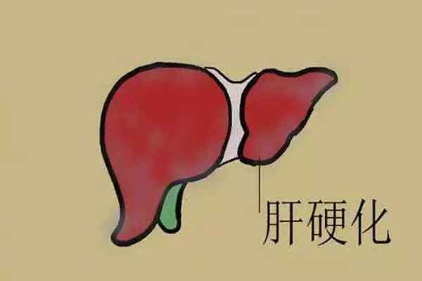 郑州治疗肝硬化的医院有哪些